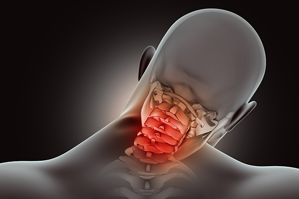 Cervical Spondylosis